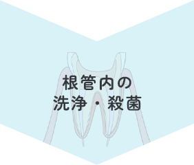 根管内の洗浄・殺菌