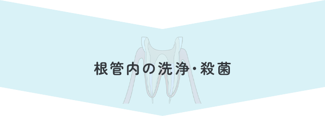 根管内の洗浄・殺菌