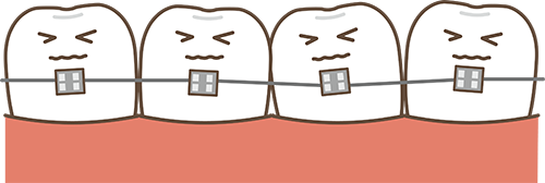 永久歯の歯並びへの影響
