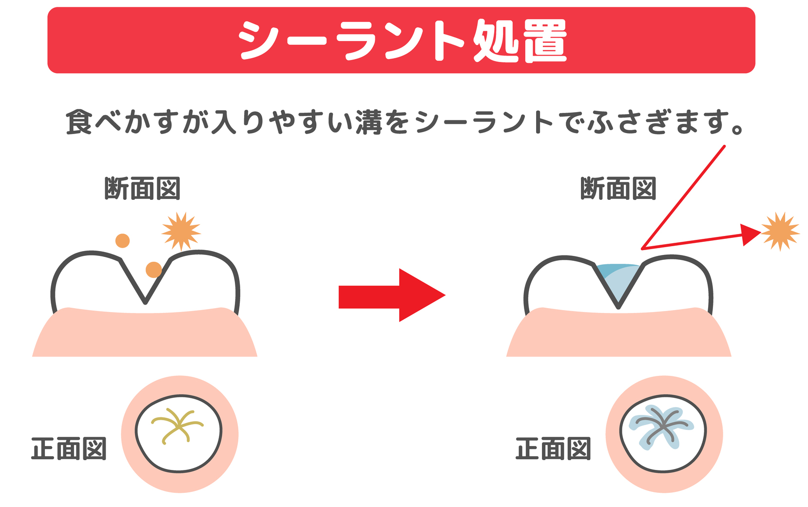 シーラントって何？目的は？